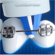 מברשת שיניים חשמלית Oral-B iO My Way